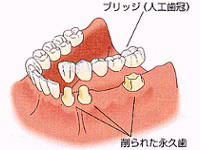 従来の治療