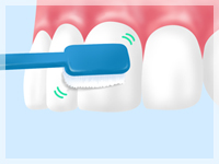 ブラッシング指導